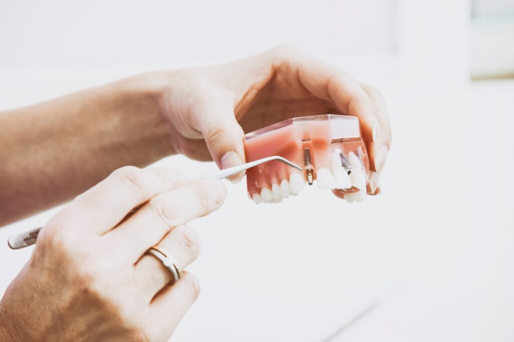 Photo Dental bridge